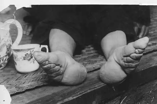 古时候三寸金莲真的很美吗