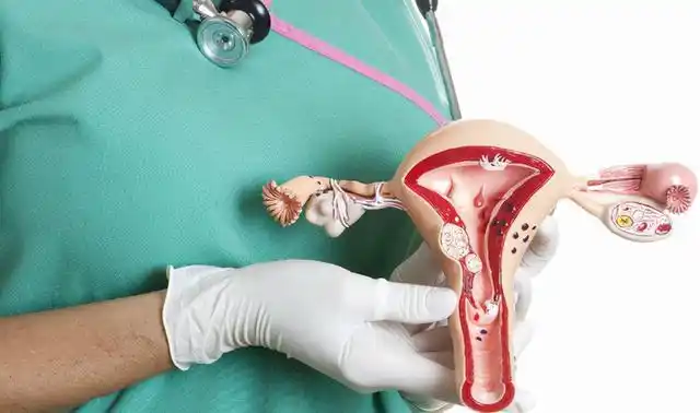 女性为什么容易长子宫肌瘤呢医生提醒尽量远离这3个行为