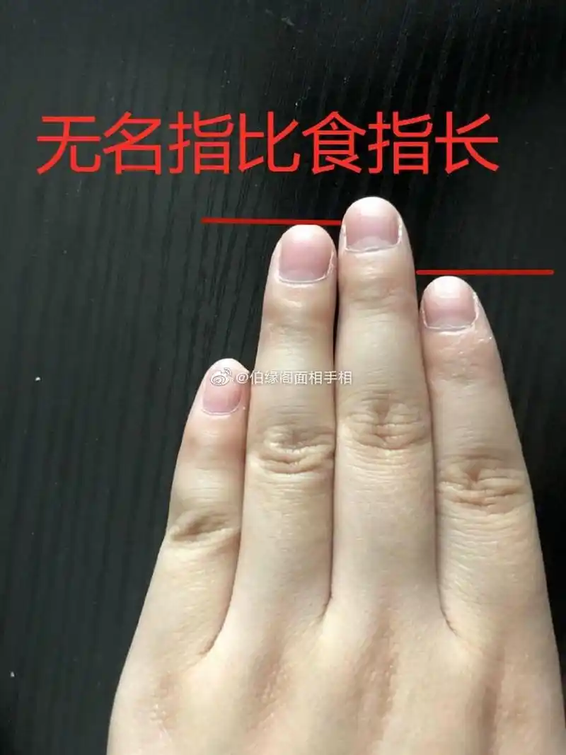 1,无名指比食指长——财运好 五指并拢,如果无名指略比食指长药些