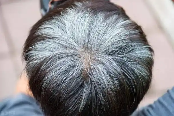 长白头发的人不易患癌?长期染发会致癌吗?白头发染发好不好