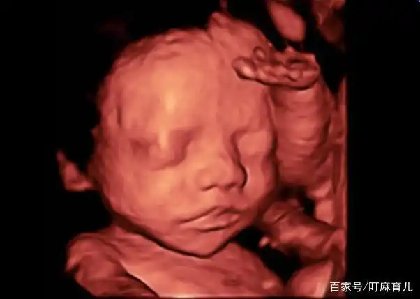 四维彩超时为什么胎儿总是捂着脸原因有四点早了解早放心