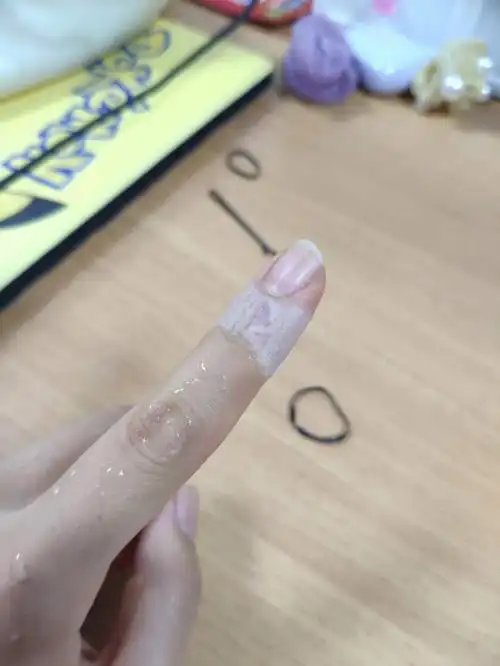 防水创可贴防了个寂寞