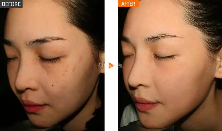 组合套餐oneday美白套餐