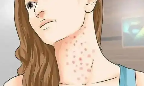 女人艾滋病的三大症状图片