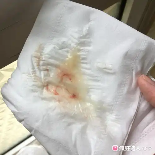 排卵期出血?有图慎点