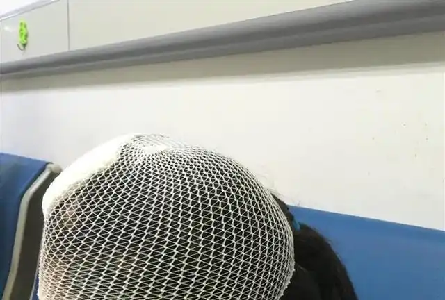 头部伤口已包扎记者随后来到武汉市三医院光谷院区,在急诊科找到受伤