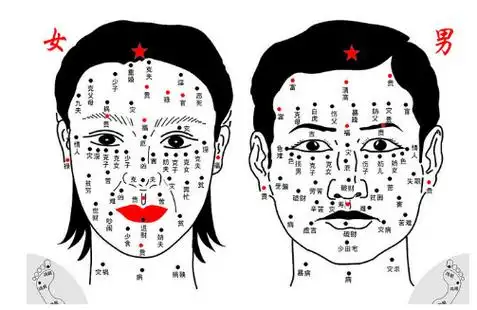 痣的位置与命运图解 颧上生女痣是不好的