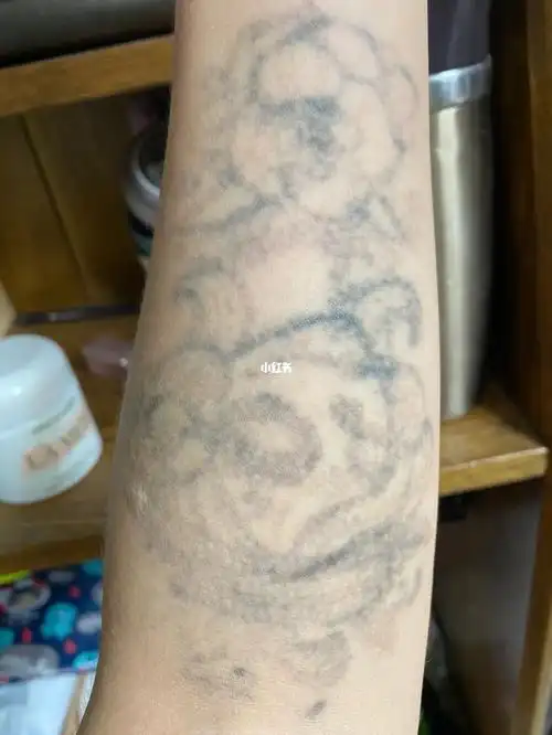 第四次洗纹身第91天