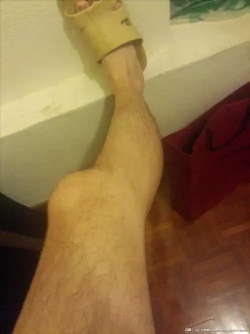 线上活动照片- 晒出你的浓密腿毛!