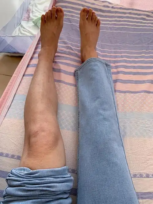 大腿53小腿347575小腿粗的姐妹都去冲吖