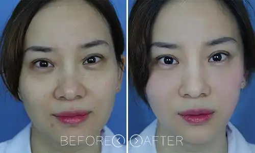 推荐医生:鲁春美莱华南旗舰院美容皮肤科副主任·中华微整形生物美容