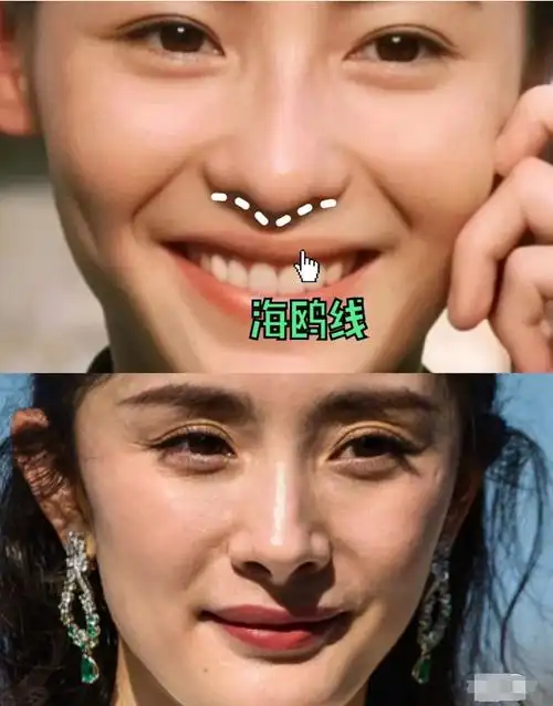 缩鼻翼要多少钱(连明星都折腾不好的鼻子) - 深圳信息港