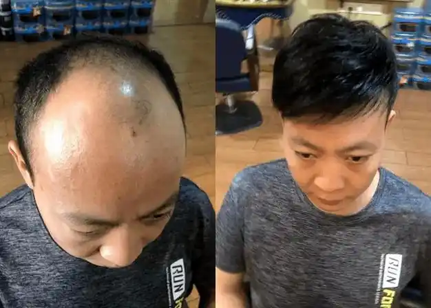 找假发定制邯郸男士必看