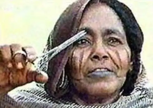 实拍印尼女孩割阴手术 令人不忍直视(图)   女孩子的割礼是一种仪式