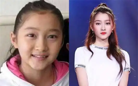 有种整容叫女大十八变躲过了杨紫关晓彤却被王诗龄圈粉