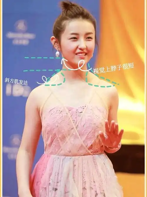 斜方肌对于气质的影响有多大