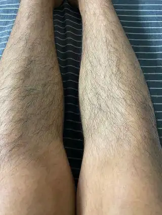 关于体毛男性真的有必要脱毛吗