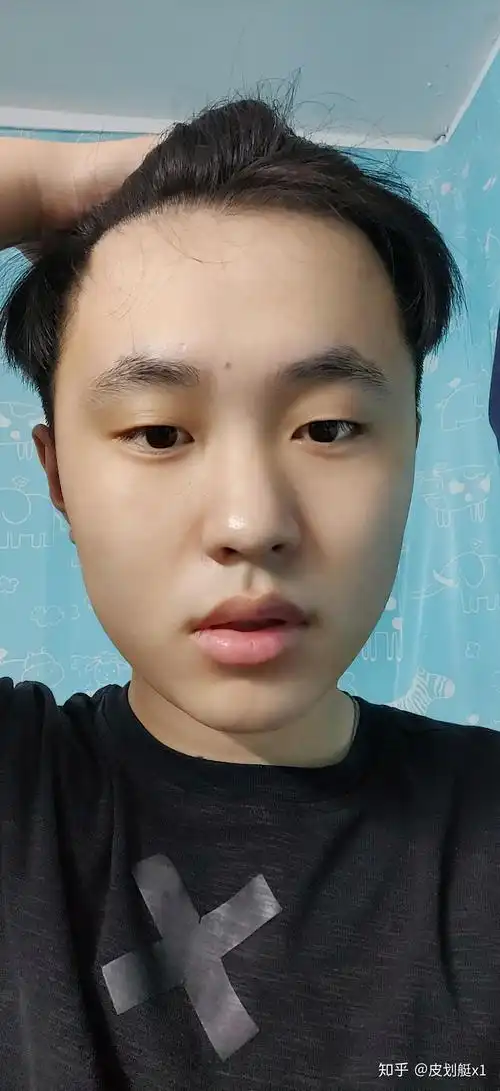 一加7pro原生无美颜照片首先是面部护肤(一天两次,一次大约2分钟,一个