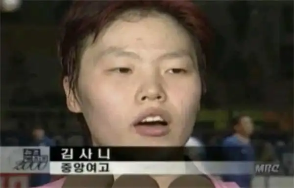 韩国女排前国手整容成功秒变女神,网友:龅牙和大饼脸都整没了!