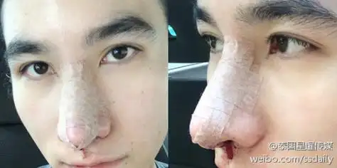 泰国男生整容成功.