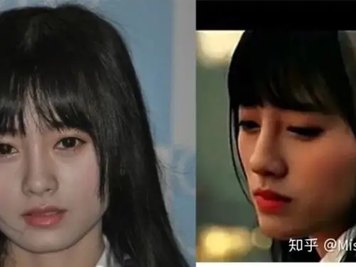 鞠婧祎的整容蕚5