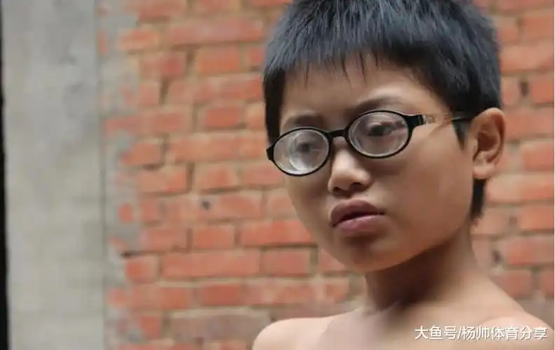 小男孩7个月就被生下, 12岁的他双眼近视达两千度