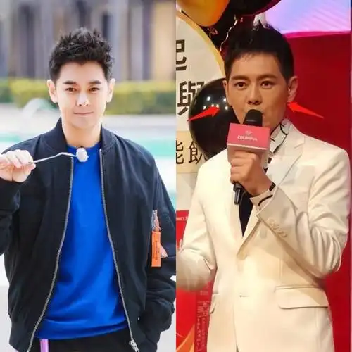 林志颖车祸后首亮相!面部僵硬,脸歪,下巴凸起,网友:活着就好