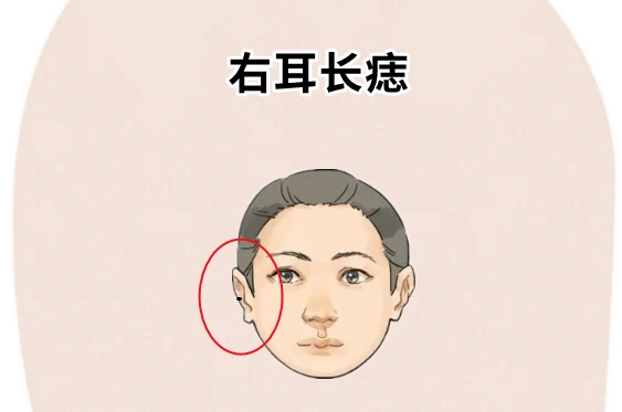常常会有"左权右财"的说法,若是女人的右耳的位置处长有吉痣,则大多数
