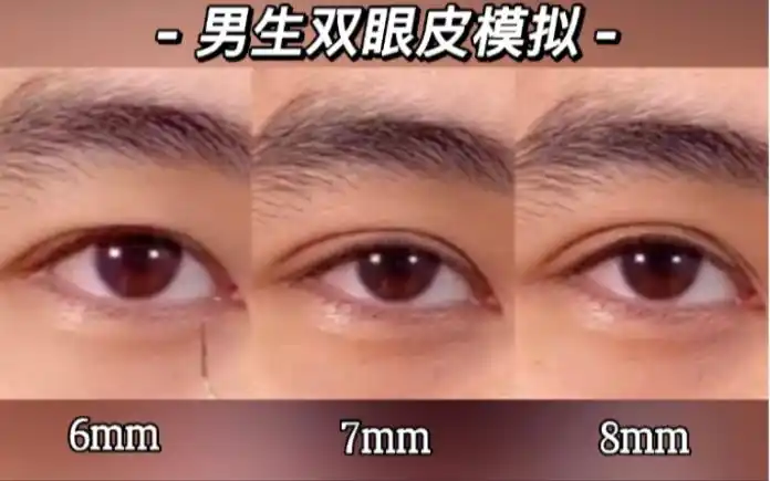 男生的双眼皮模拟6mm7mm和8mm哪个是你的心动款