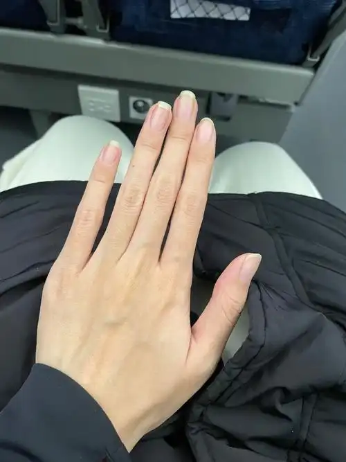 出差路上刷到马凡综合征整个人都不好了01