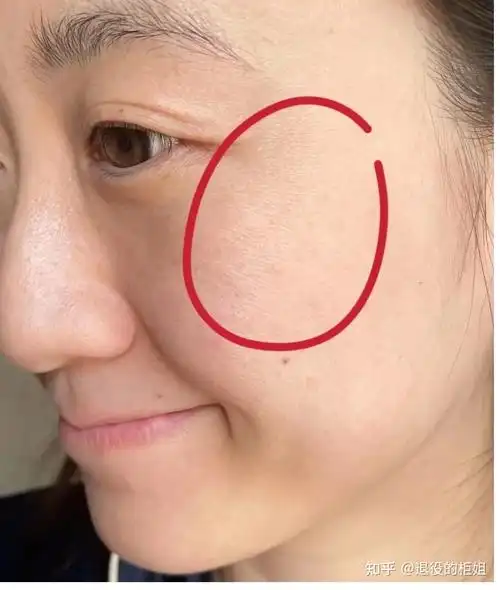 皮肤缺水一般有哪些表象?秋冬皮肤干燥脱皮爆皮怎么办? - 知乎