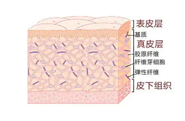 我们的皮肤大致分为表皮层,真皮层,皮下组织3个结构.