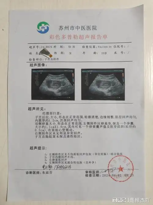 开急性肠胃炎住院证明图片急性肠胃炎入院记录怀孕血检唐山宫外孕开