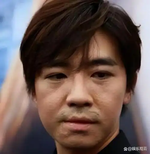 俞灏明:严重烧伤"整容"重生,坚持拍戏他打了多少明星的脸