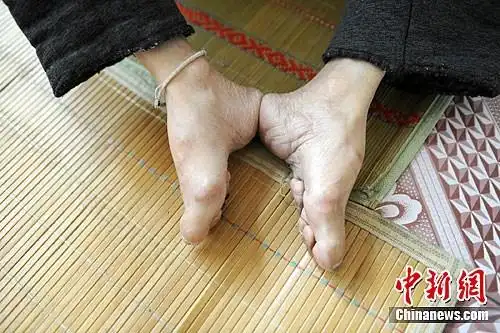 陕西泾阳县最后的"三寸金莲"(3)