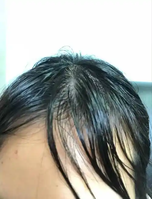 头发超级油每天都要洗头有没有推荐的油头洗发水