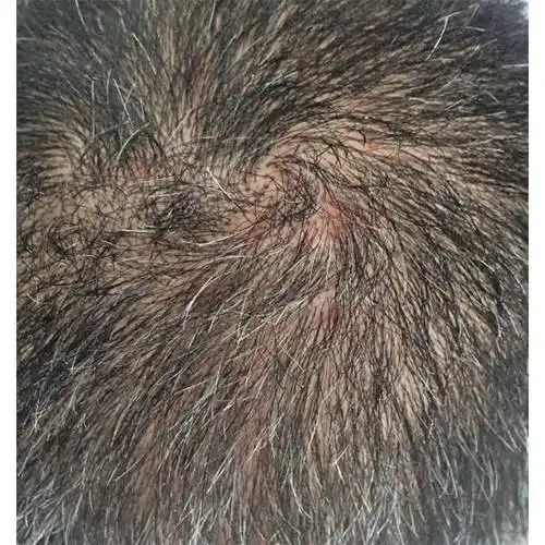 柔润去屑洗发水推荐_头皮屑_问题_头发