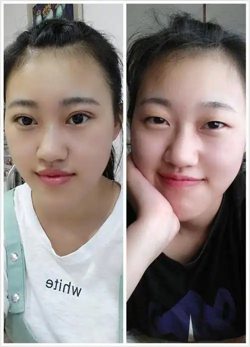 简单的一组双眼皮前后对比照 自然系