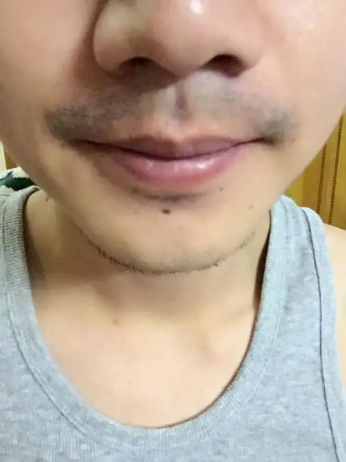 胡须很粗,每天剃完都会有胡渣,上午剃完下午就又很粗黑,就是不能剃得