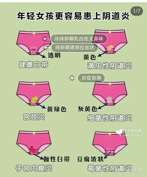 常见的妇科炎症需要注意什么