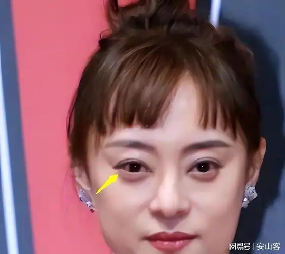 这一次,被"露大腿"的孙俪惊艳,颜值已回春,甩整容脸几条街|杨幂|唐嫣