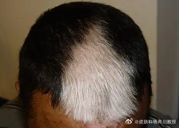 深圳女副区长一撮白发被指挑染