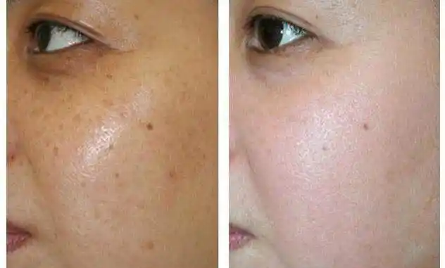 暗黄肌out这个早午晚亮肌法是你们的皮肤救星