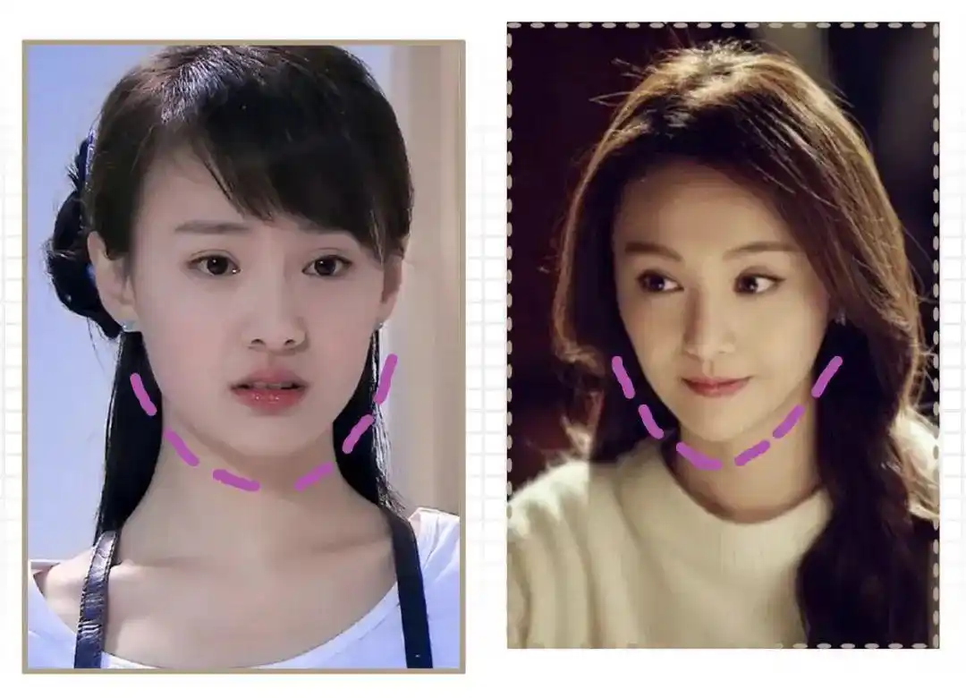 刚出道时的郑爽,脸型算不上精致, 下颌线比较圆润线条不够明显