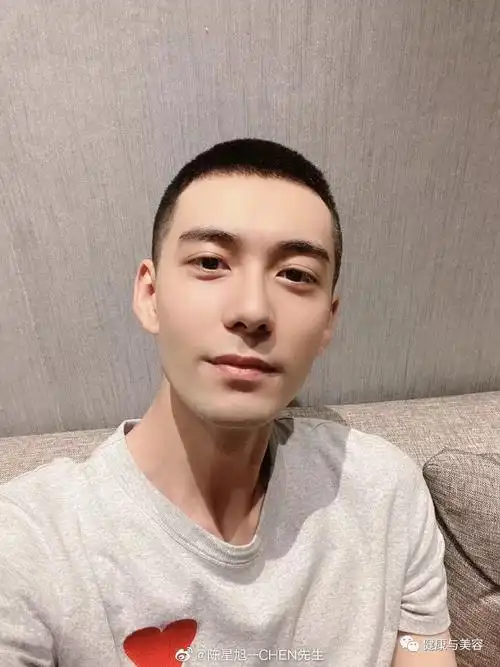 李易峰,陈星旭剪寸头,难看的m型发际线如何避免?_处理