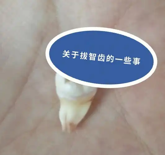 拔智齿丨昨天拔了我的第三个智齿