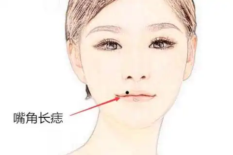 女人身上的四个离婚痣有哪些