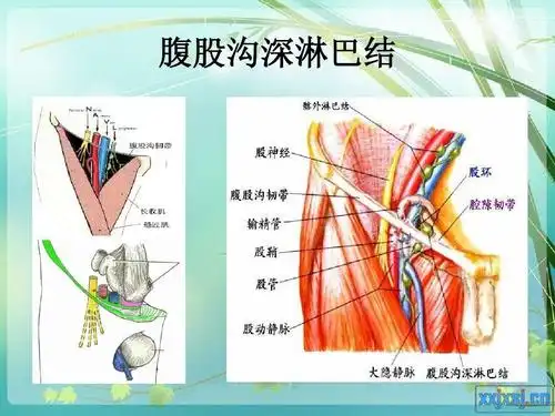 腹股沟深淋巴结