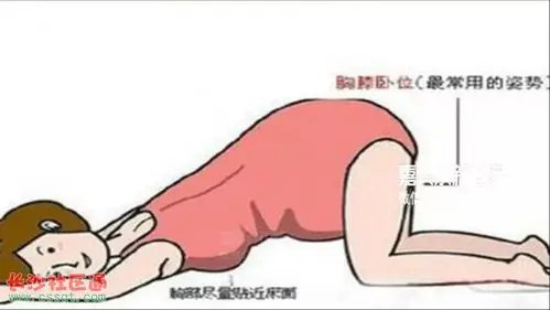 我回家就开始做纠正体位的趴着的姿势,早上一次,晚上一次,(每次)大概