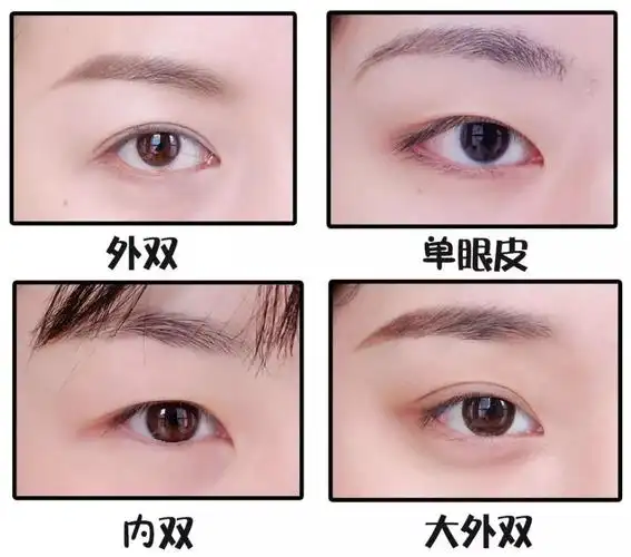 下面来看看我们比较常见的四种眼型:外双,单眼皮,内双,大外双.